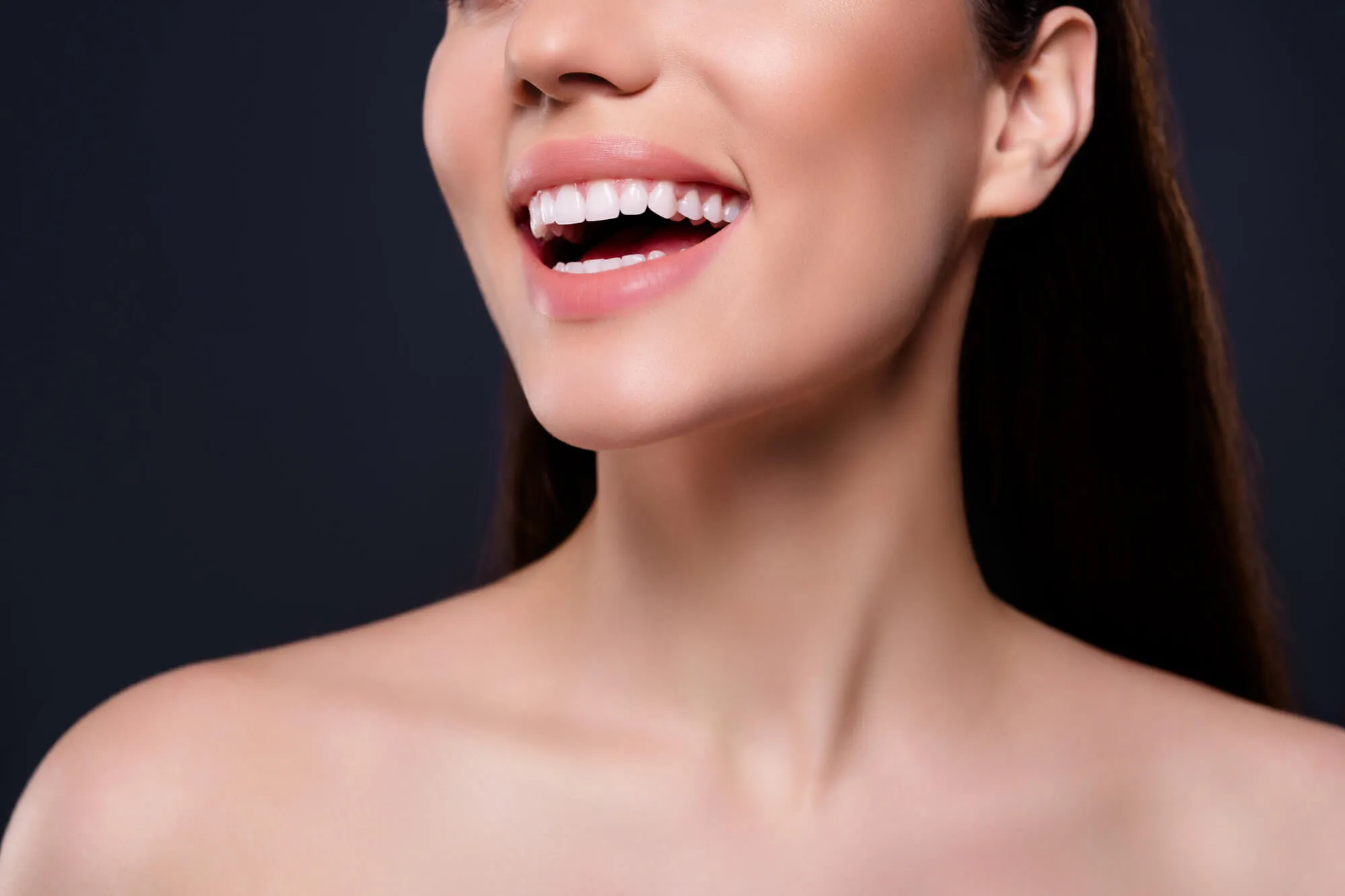 smiling wearing veneers orlando