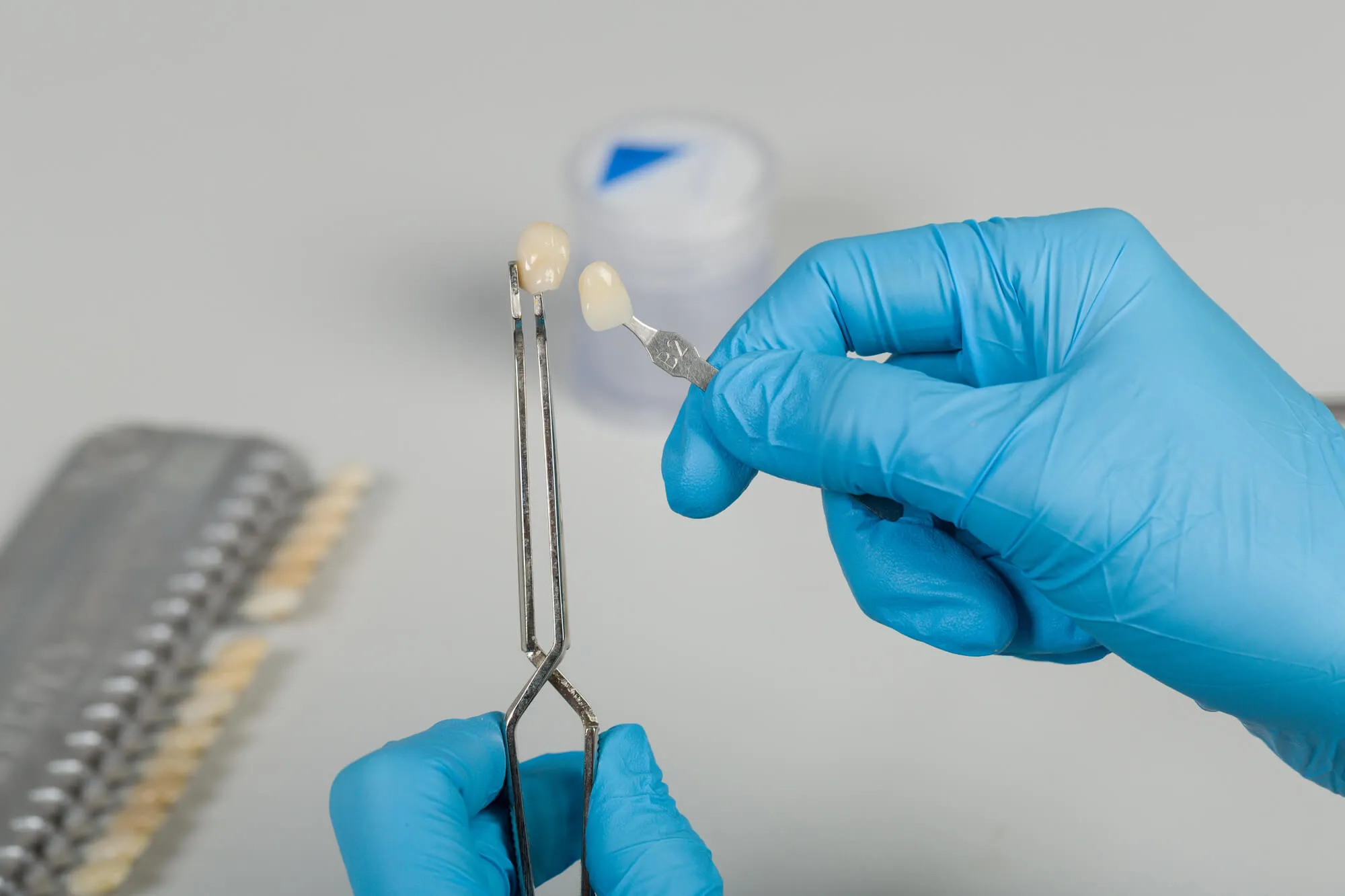 same day crowns orlando