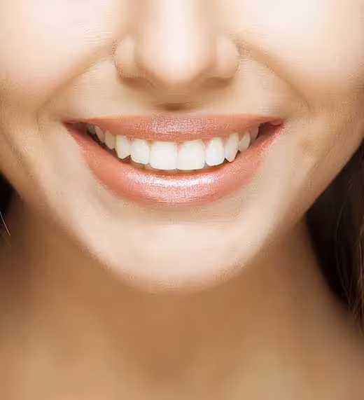 FULL MOUTH RECONSTRUCTION