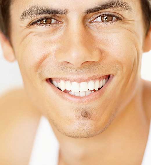 FULL MOUTH RECONSTRUCTION