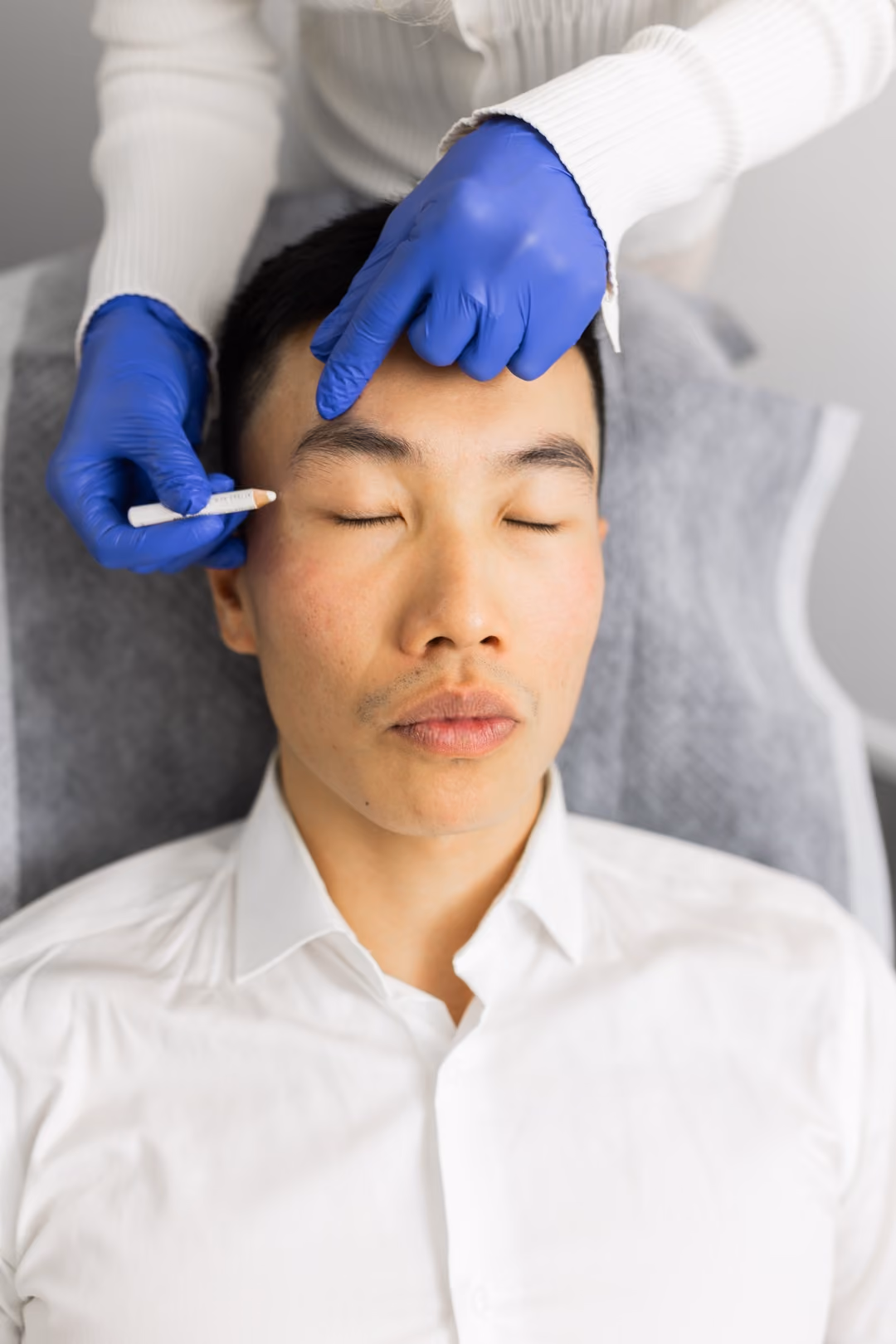 Practitioner in blue gloves marking treatment points on a client's brow before treatment