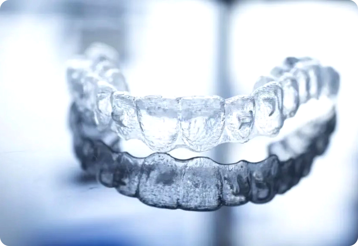 3d printed braces
