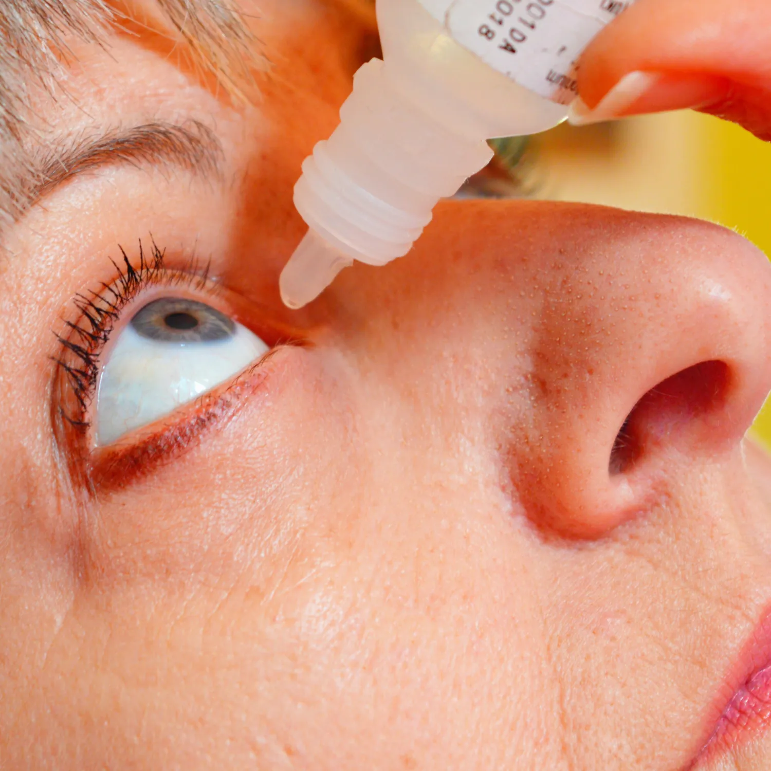 Patient applying lubricating eye drops for dry eye syndrome relief and treatment