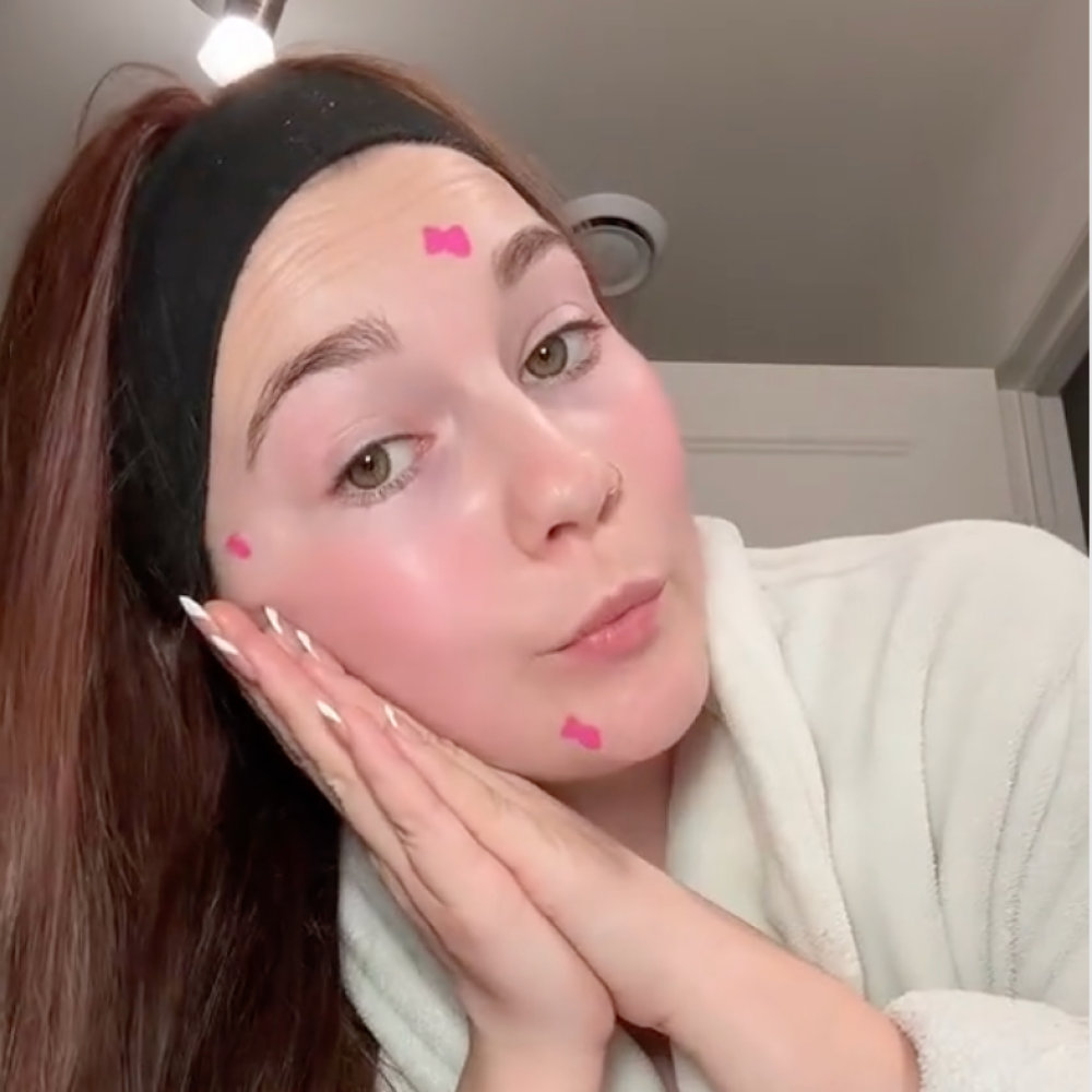 Young woman with brown hair in a black headband and white robe gently pressing her hands to her cheek, with small pink marks on her face.