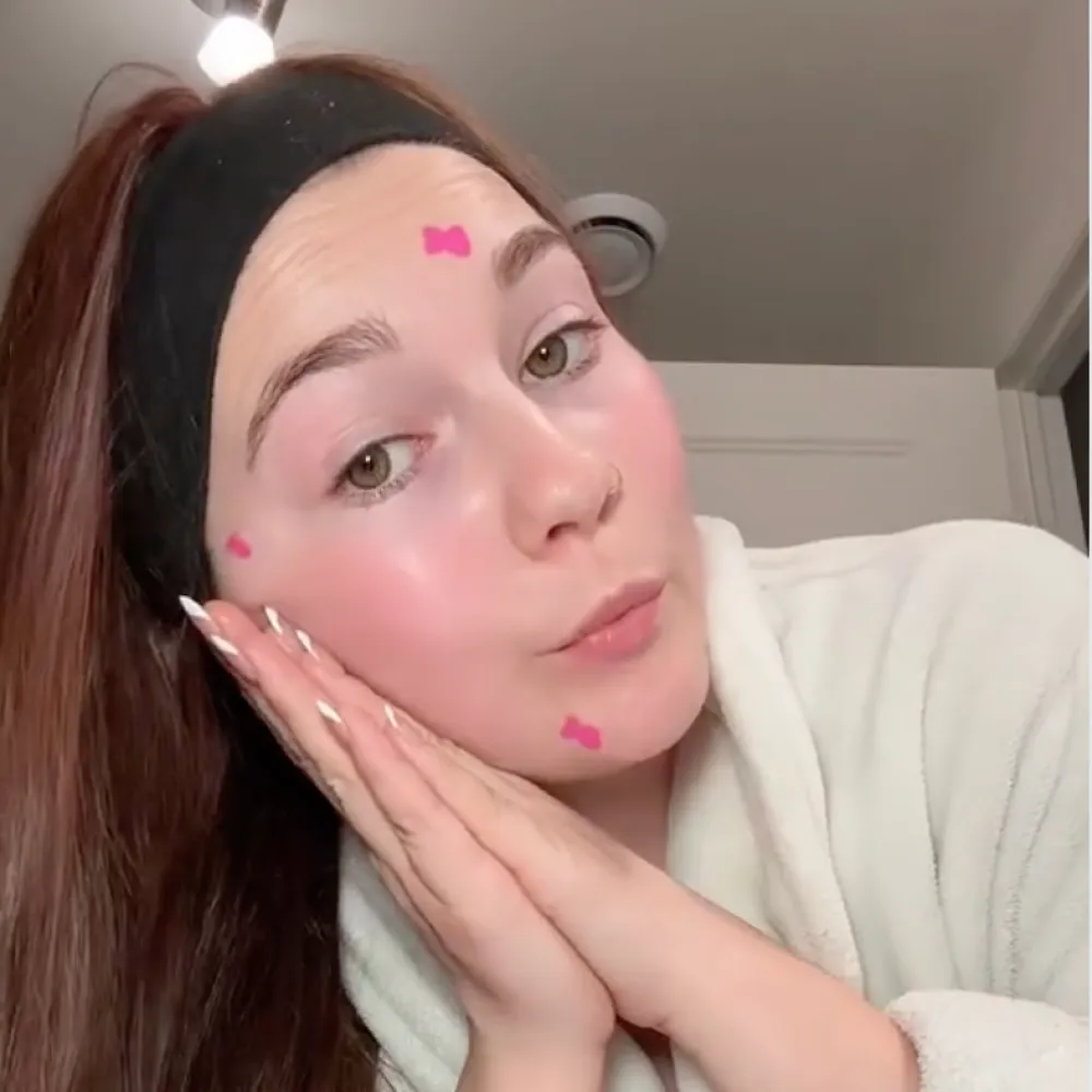 Young woman with brown hair in a black headband and white robe gently pressing her hands to her cheek, with small pink marks on her face.