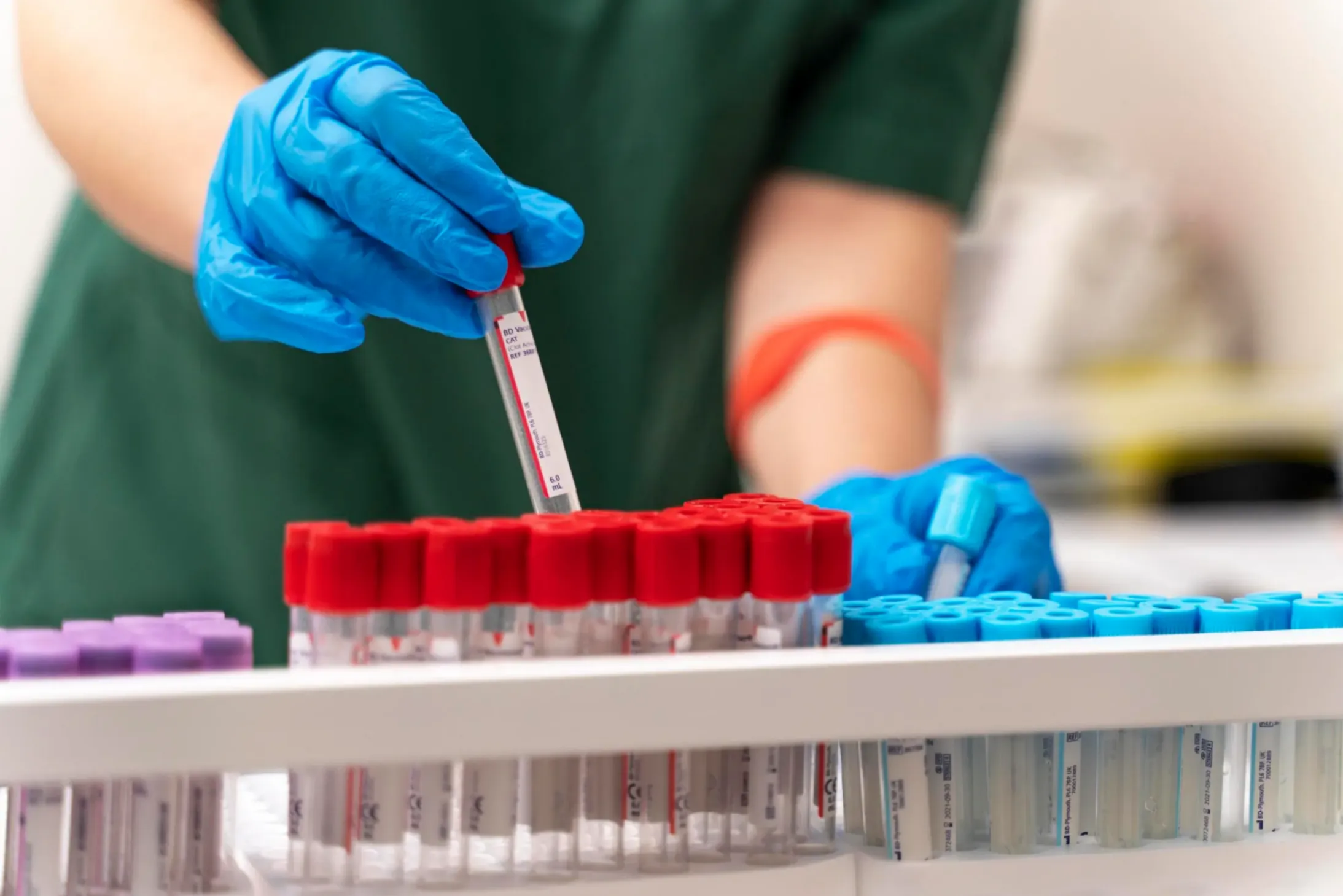 éprouvettes dans un laboratoire et une technicienne qui fait des prélévements