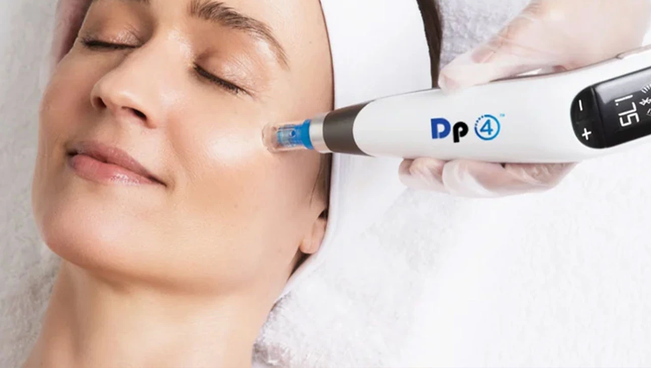 Une personne recevant un traitement de microdermabrasion à l'aide d'un appareil Dp4 sur la joue.