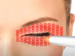 Femme appliquant du maquillage sous l'œil fermé avec un pinceau sur un visage partiel. Clinique SkinIn, brossard