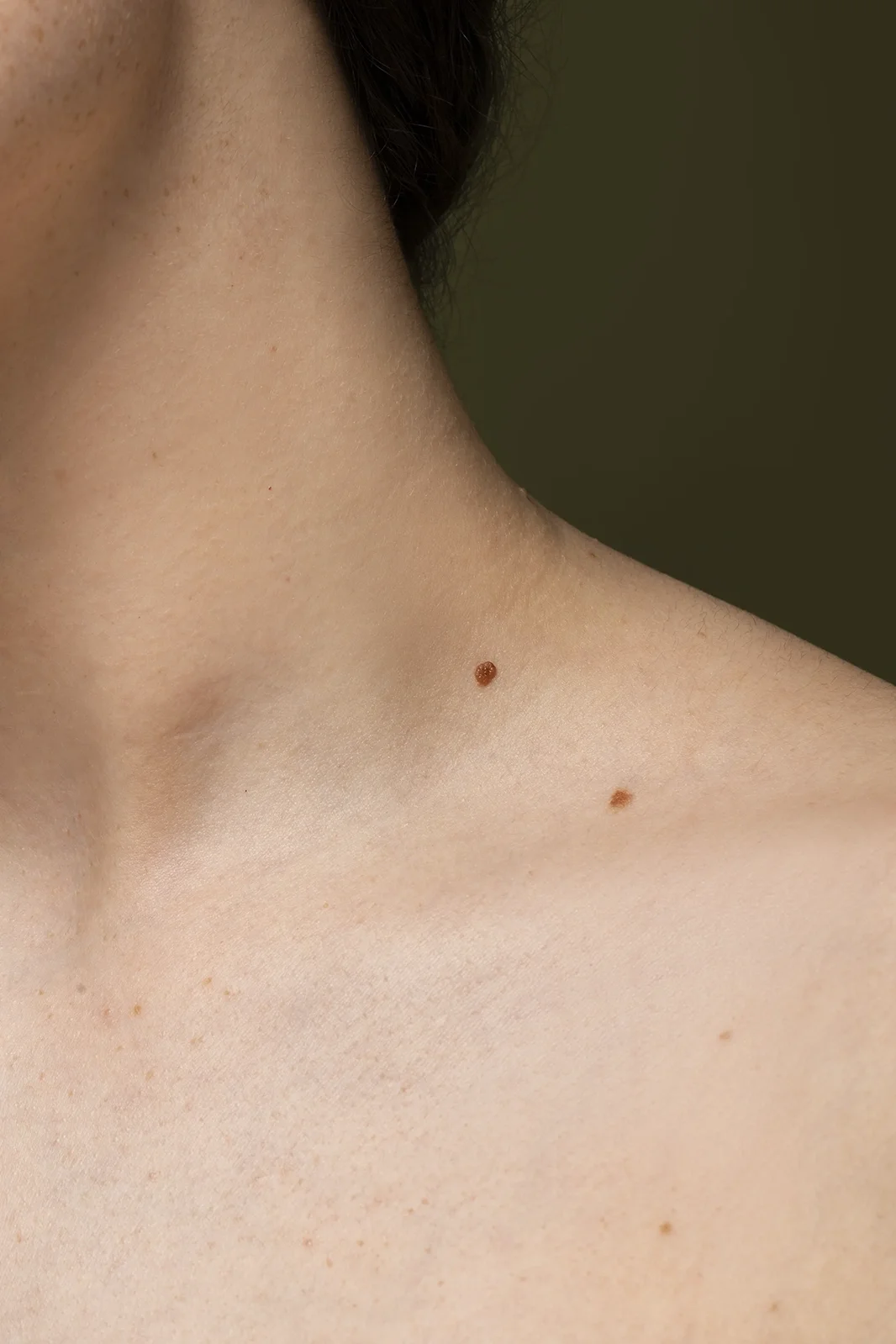Close up of light skin on a neck with two brown moles visible near the collarbone.