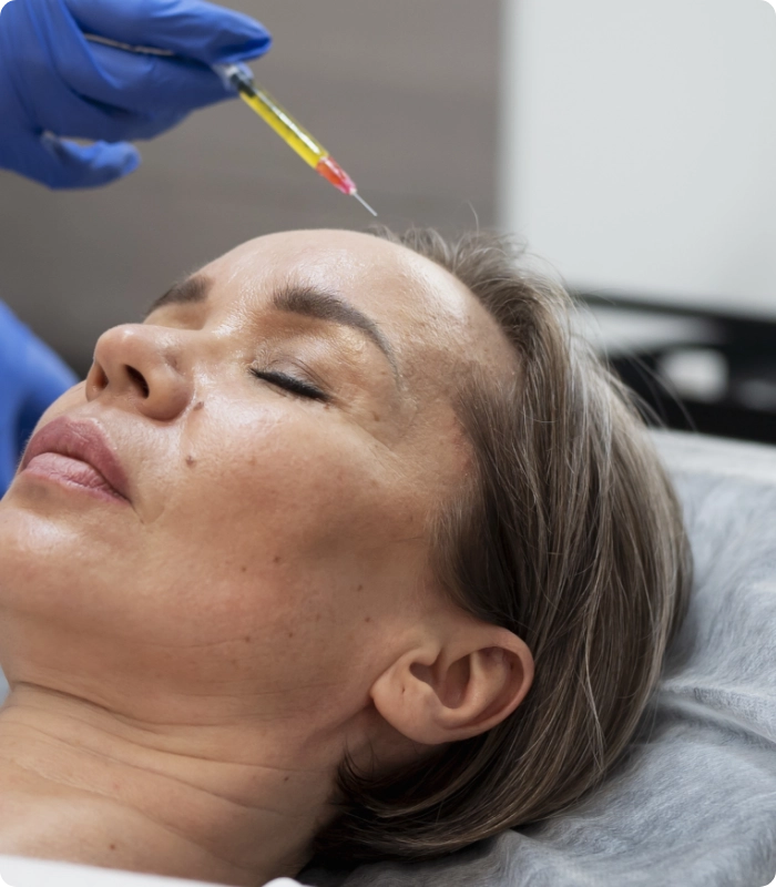 Une femme allongée avec les yeux fermés recevant une injection faciale de plasma riche en plaquettes par une personne gantée. PRP clinique skinin