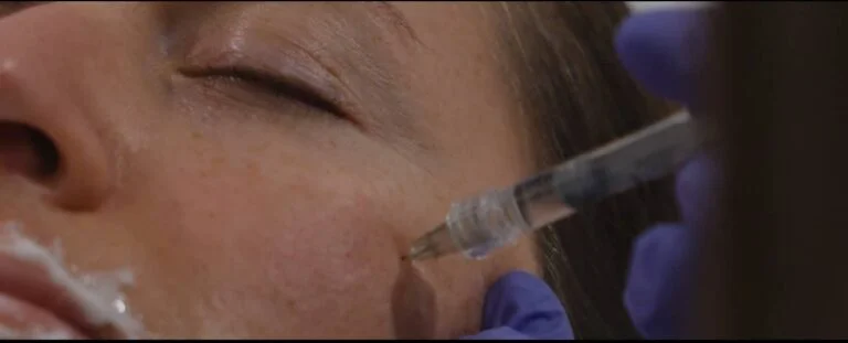 Person reçoit une injection près de la joue avec une seringue tenue par une main gantée.