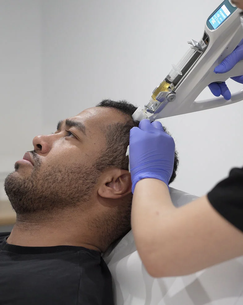 Un homme reçoit un traitement médical au cuir chevelu avec un appareil injecteur tenu par une personne portant des gants violets.