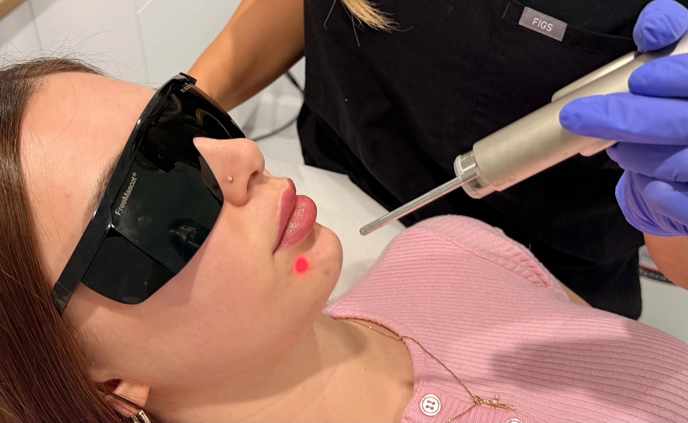 Une femme portant des lunettes de protection reçoit un traitement au laser sur le menton.