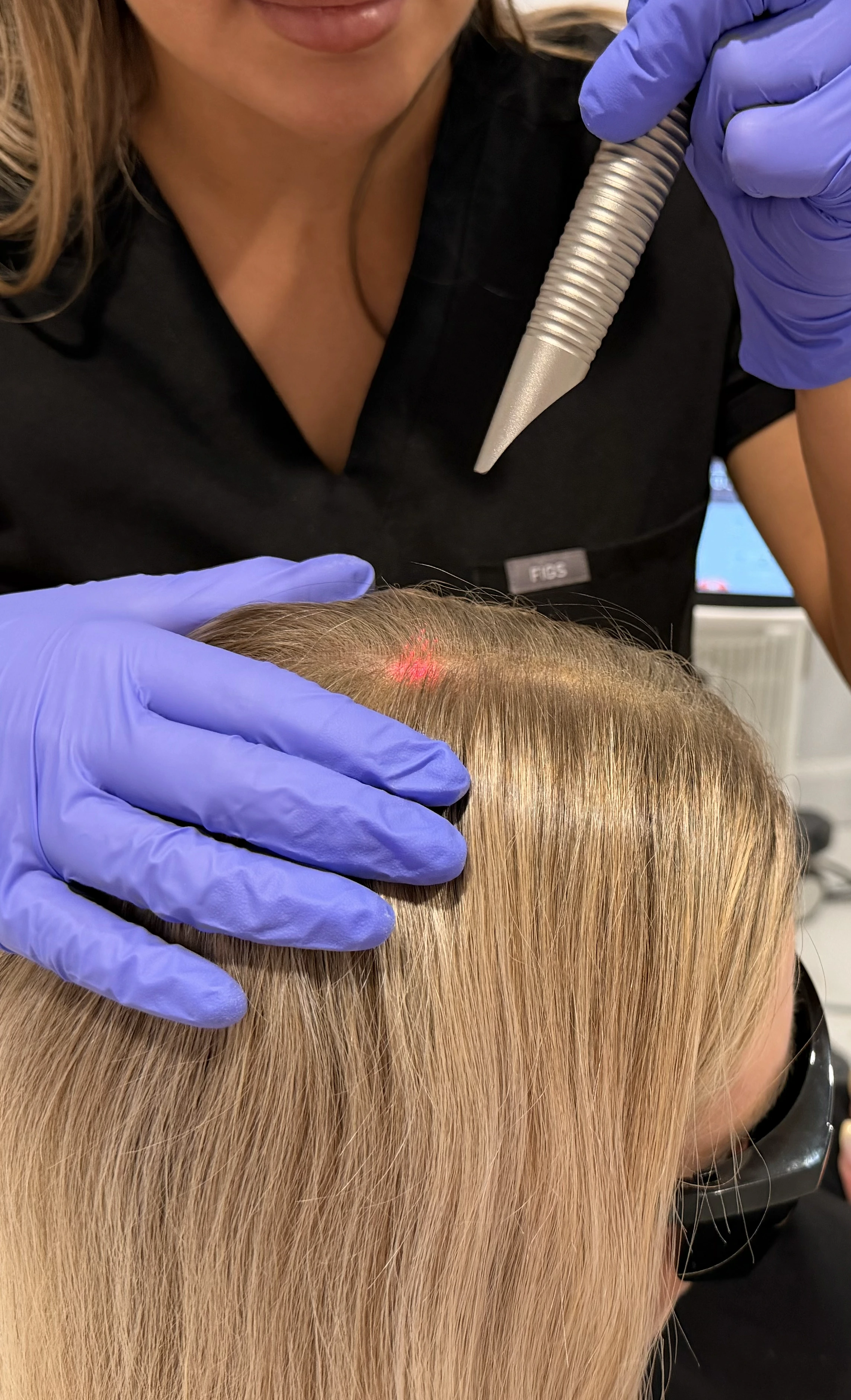 Technicienne en gants violets effectue un traitement laser sur le cuir chevelu d'une femme blonde.
