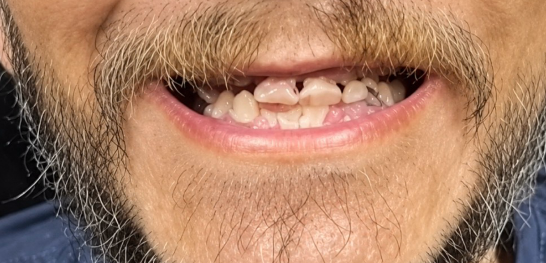 Before Image