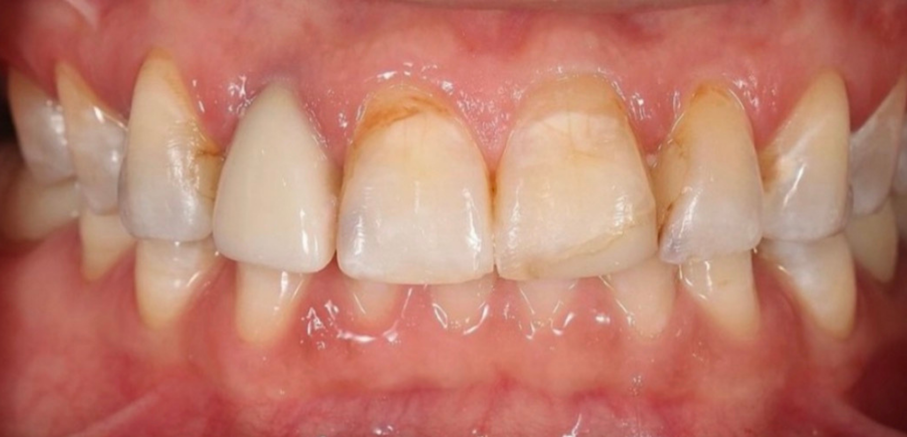 Before Image