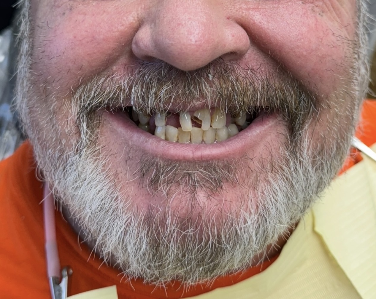 Before Image