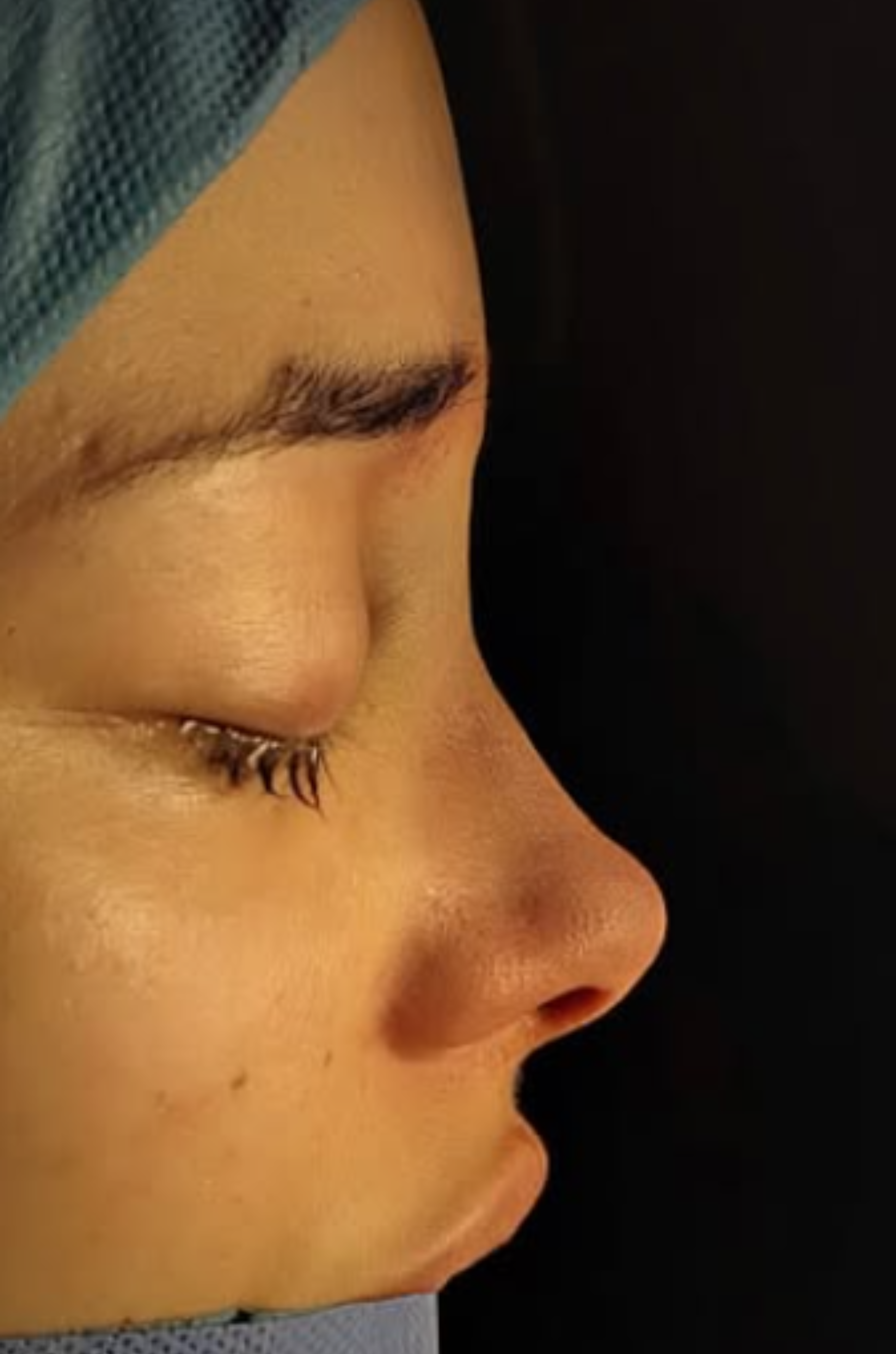 Close-up side profile of a person with closed eyes wearing a blue surgical cap.