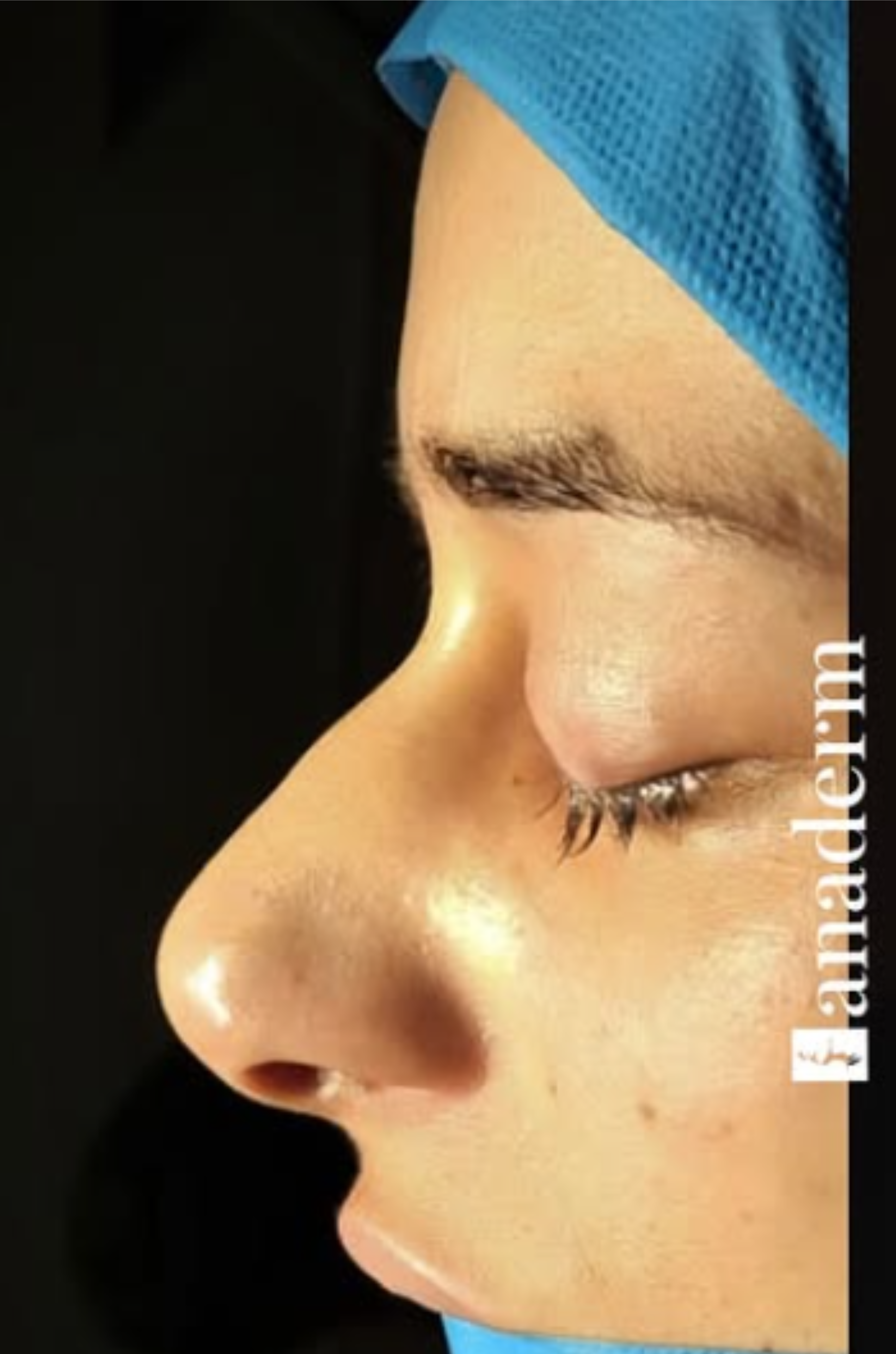 Close-up side profile of a person's face with eyes closed, wearing a blue head covering against a black background.