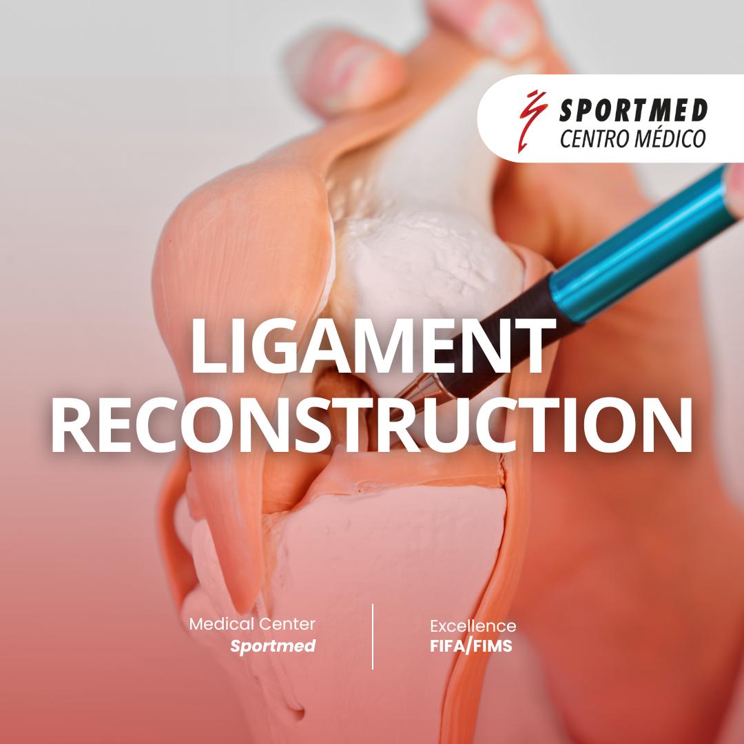 Ligament Reconstruction