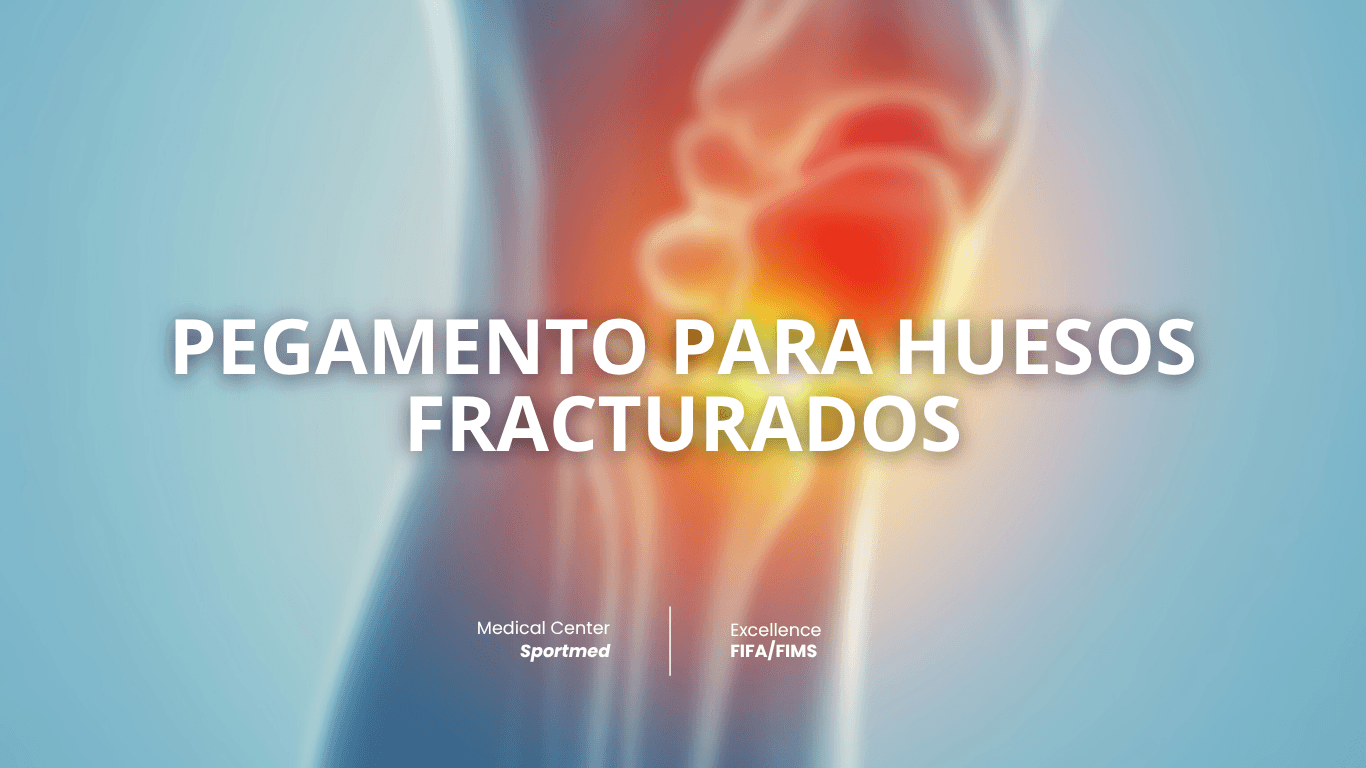 Pegamento para huesos fracturados