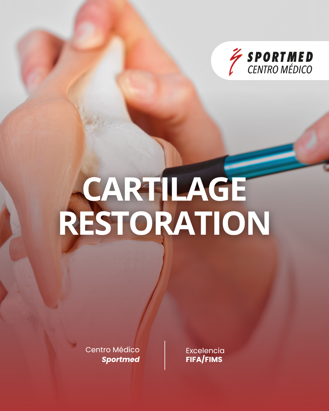 Cartilage Restoration
