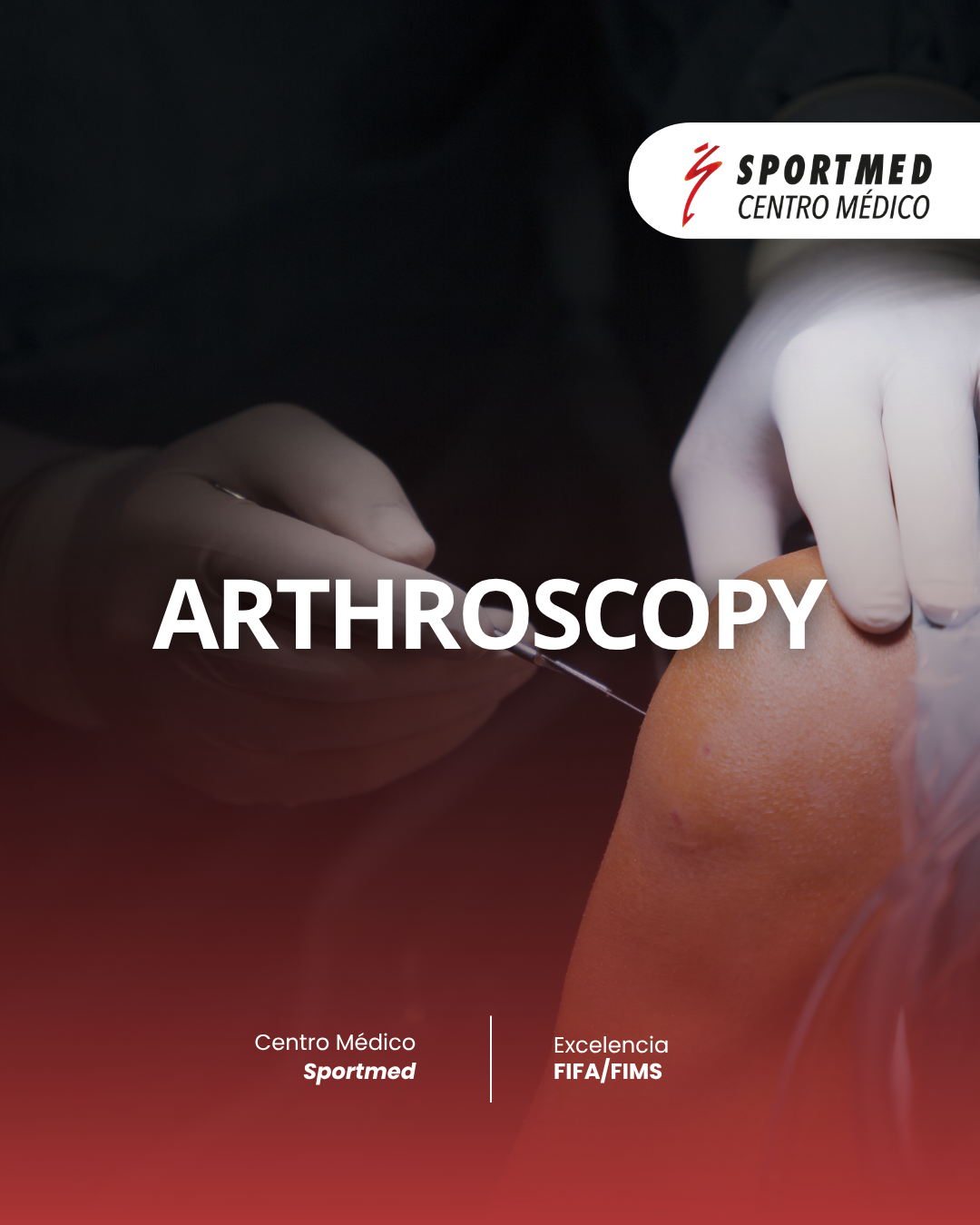 Arthroscopy