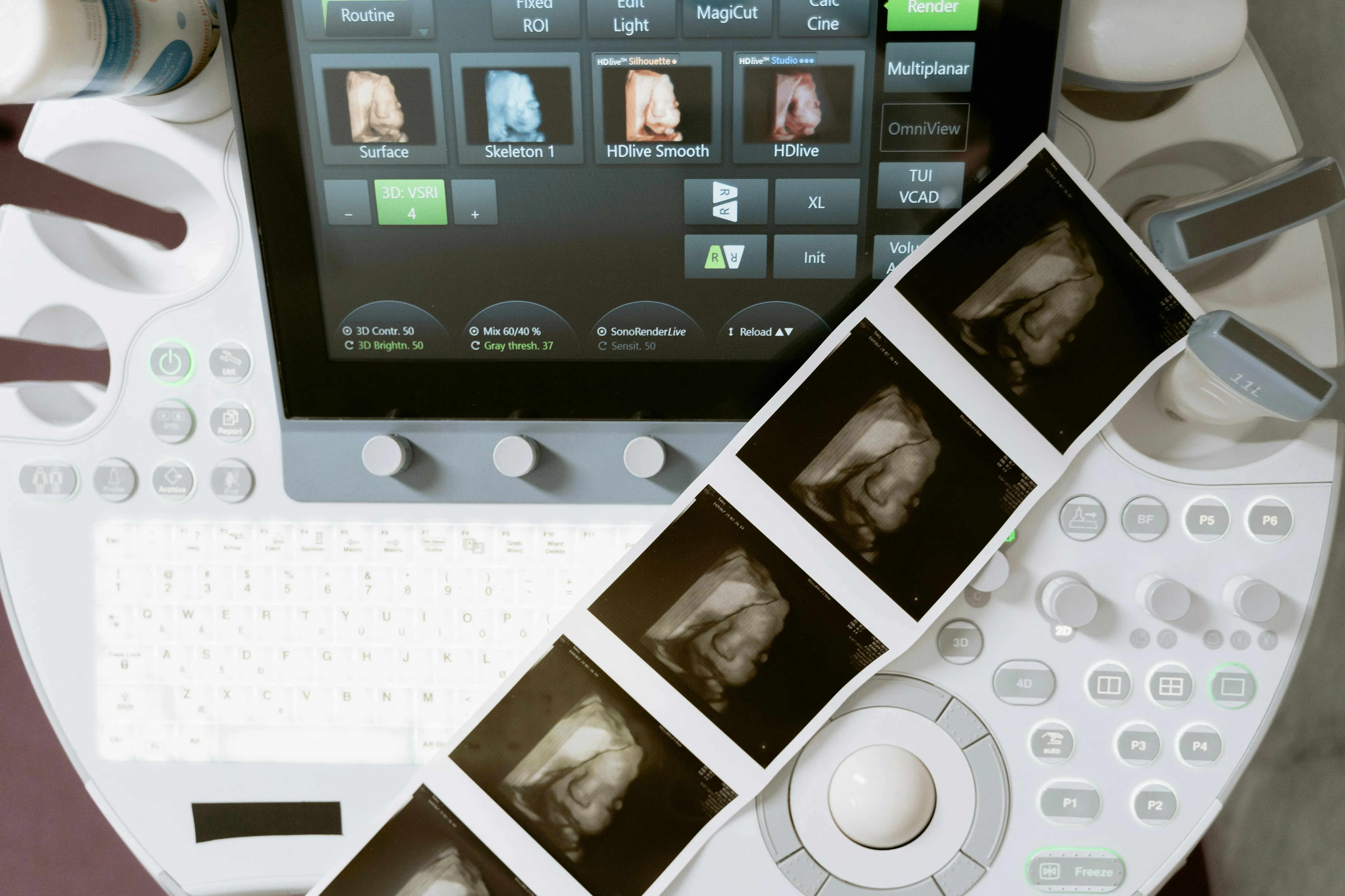 Medical imaging equipment displaying scan results
