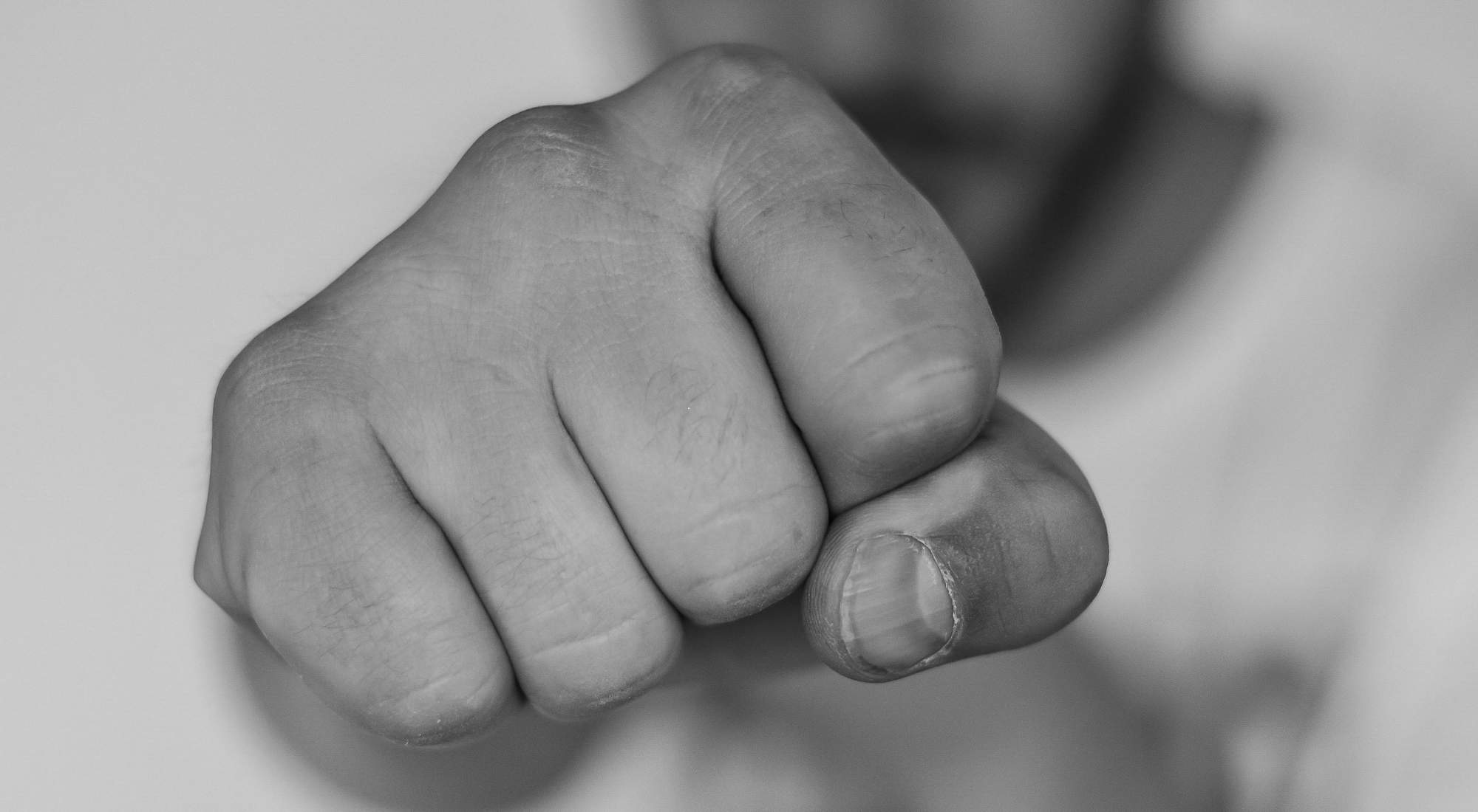 alcoholic rage syndrome