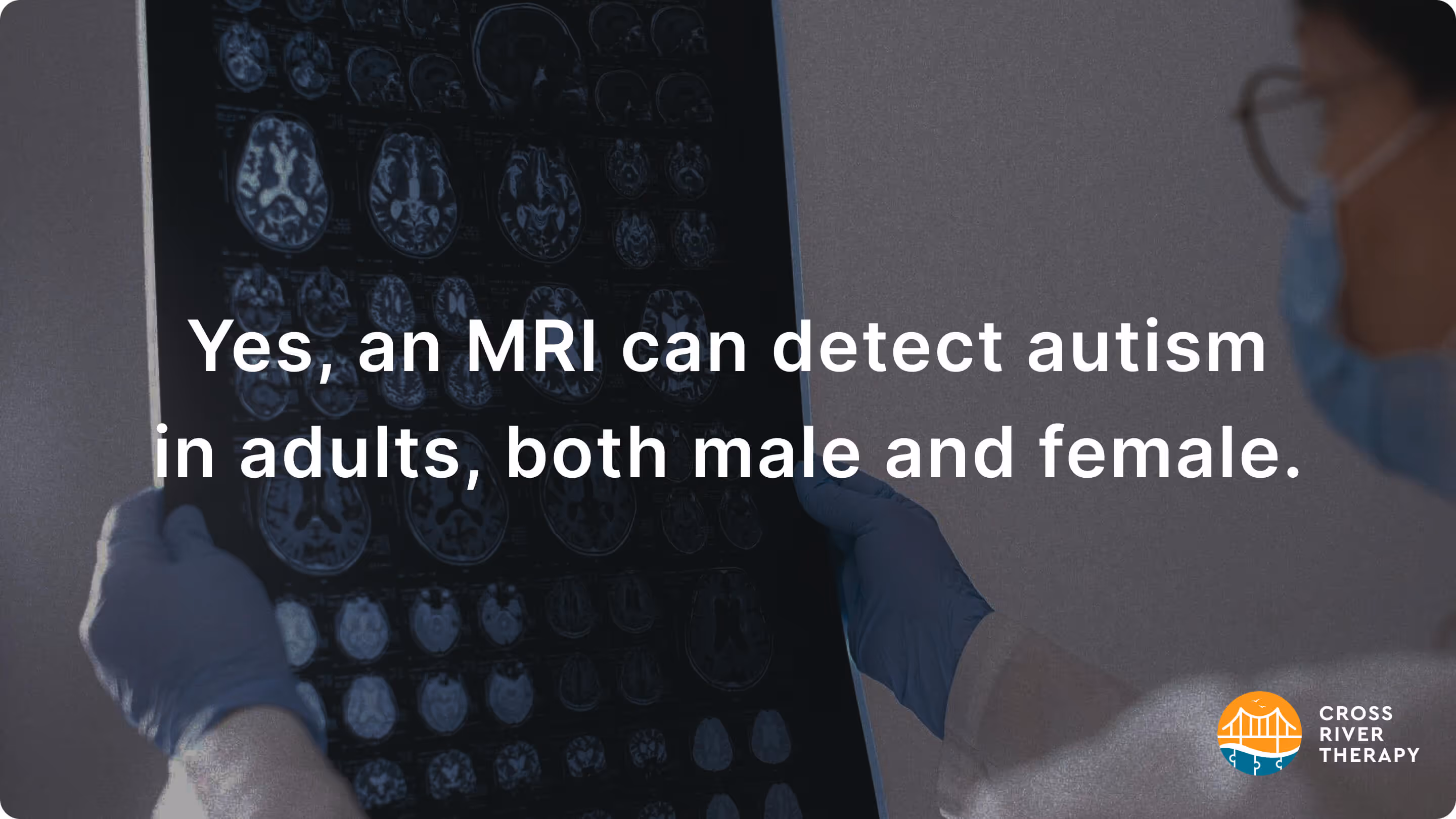 Can An MRI Detect Autism In Adults?