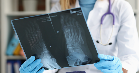 Digital X-ray  treatment in Manhasset, New York