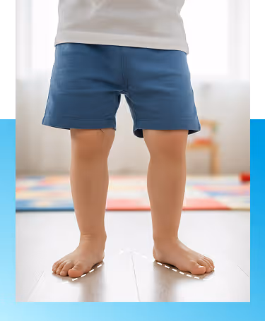 Out-toeing Evaluation in Manhasset, New York