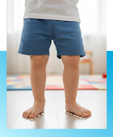 Out-toeing Evaluation in Manhasset, New York
