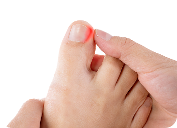 Ingrown Toenail Treatment in Manhasset, New York
