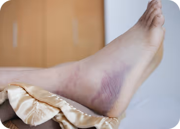 Diabetic wound care treatment in Manhasset, NY