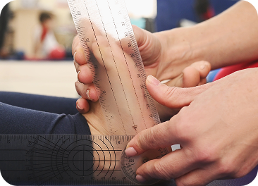 Flat feet in children treatment in Manhasset, NY