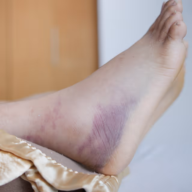 Diabetic wound care treatment in Manhasset, NY