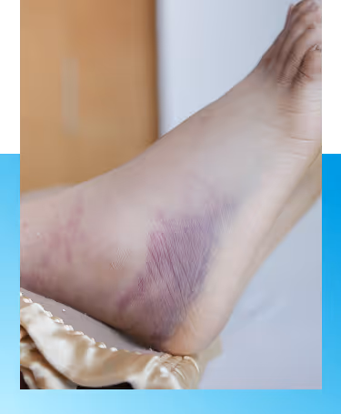 Diabetic wound care treatment in Manhasset, NY