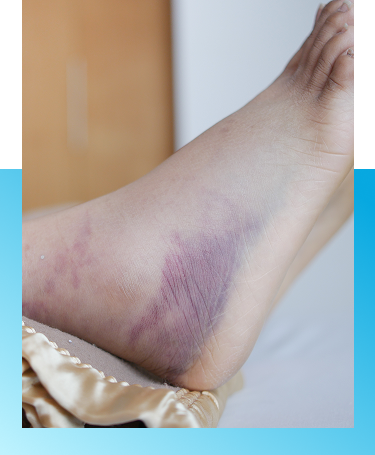 Diabetic wound care treatment in Manhasset, NY