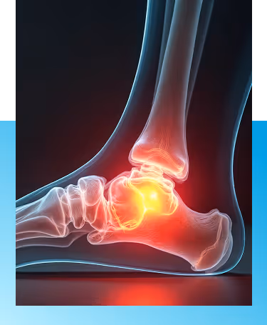 Stress fracture treatment in Manhasset, NY
