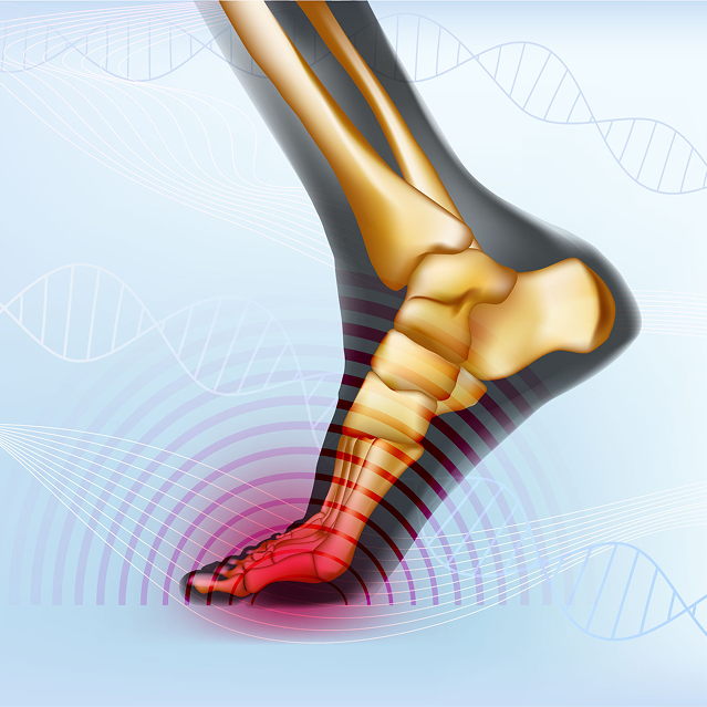 Turf toe treatment in Manhasset, NY