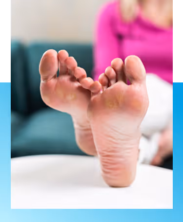 Corns & Calluses Treatment in Manhasset, New York