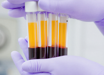 Gloved hands holding five test tubes filled with separated blood samples showing clear yellow plasma above red blood cells.