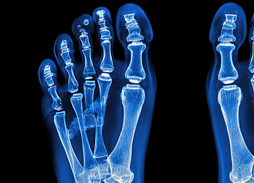 Digital X-ray treatment in Manhasset, New York
