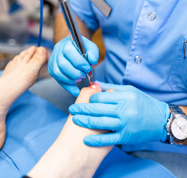 Laser Toenail Fungus Treatment in Manhasset, New York