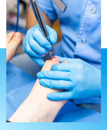 Laser Toenail Fungus Treatment in Manhasset, New York