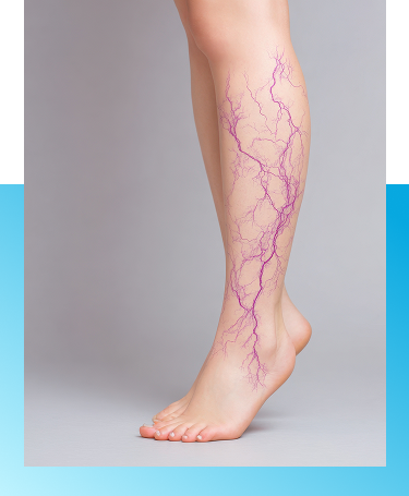 Vascular Testing (ABI) treatment in Manhasset, New York
