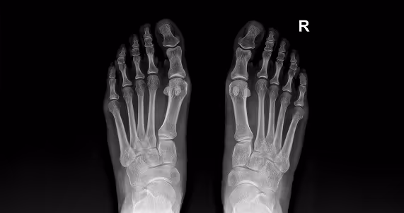 foot x ray showing bones and structure