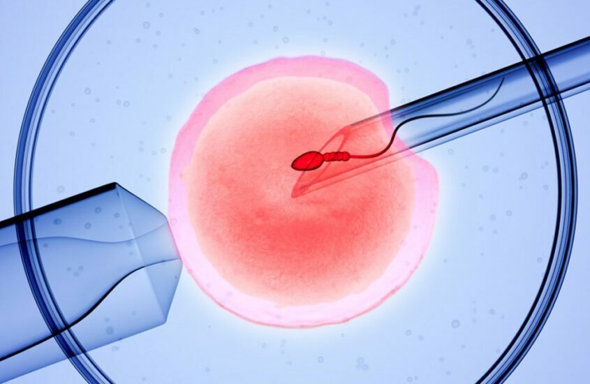 IVF process from start to finish