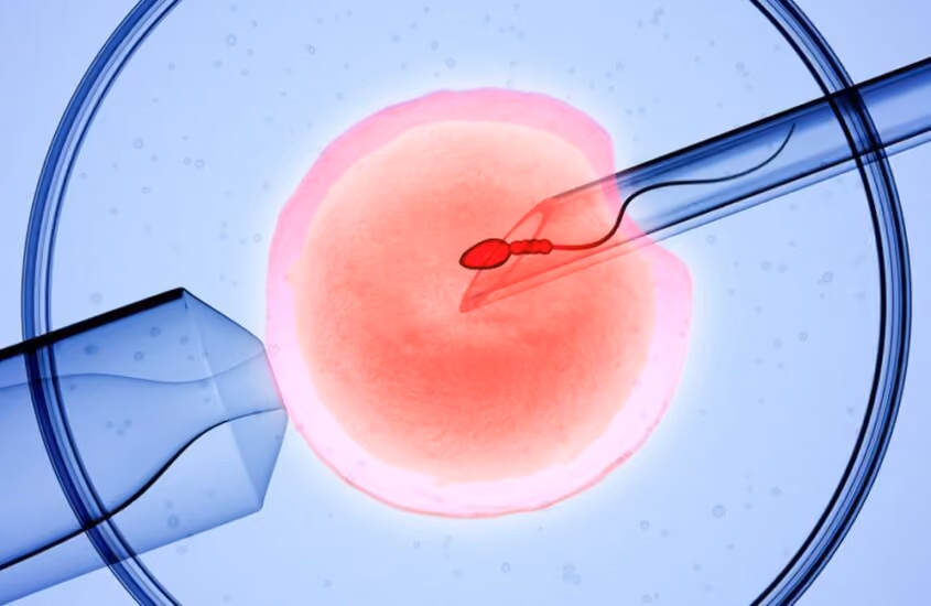 IVF process from start to finish